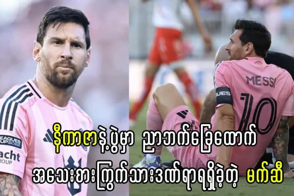 အသေးစားကြွက်သားဒဏ်ရာရရှိခဲ့တဲ့ မက်ဆီ xda77