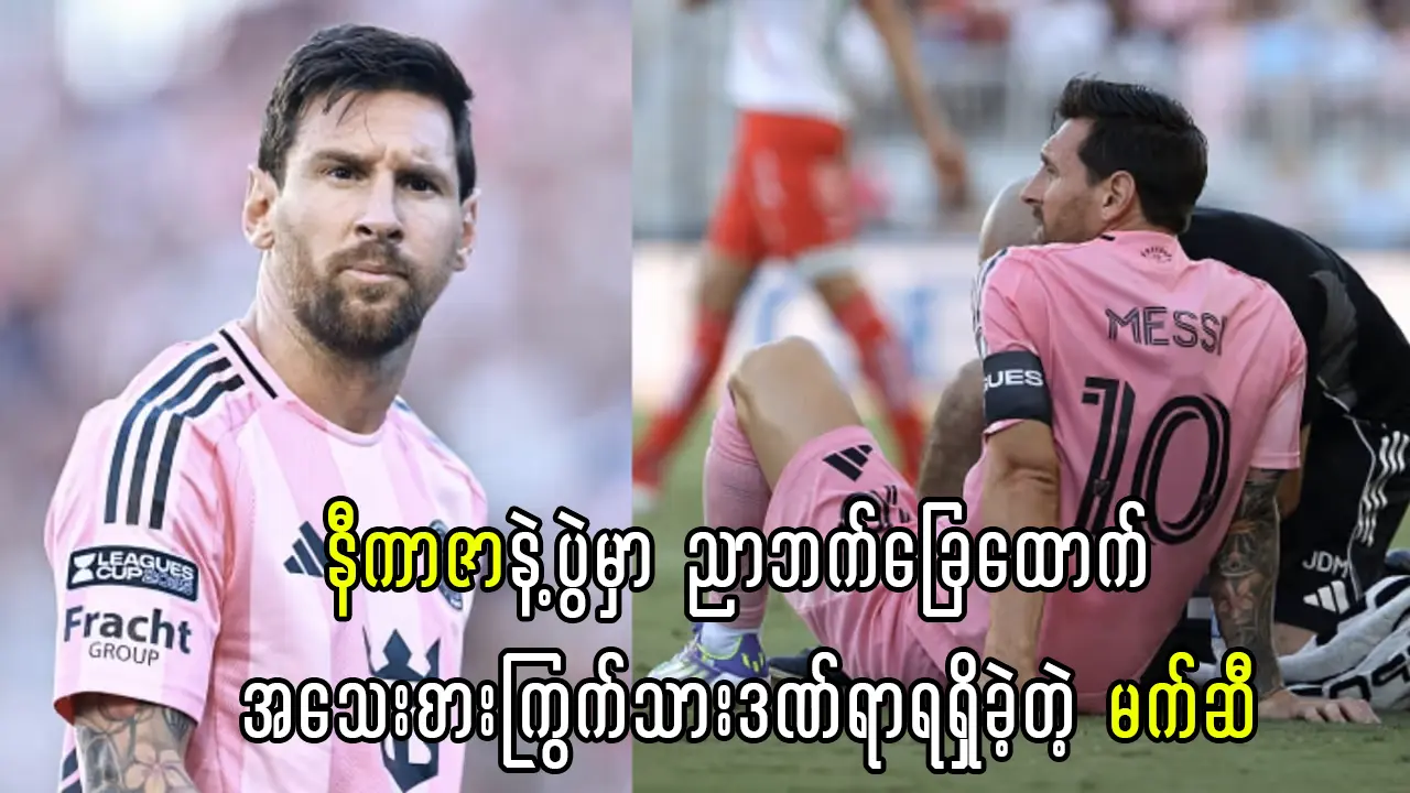 အသေးစားကြွက်သားဒဏ်ရာရရှိခဲ့တဲ့ မက်ဆီ xda77